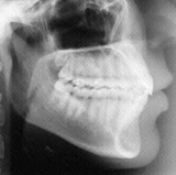 Radiologia Odontológica em Aracaju